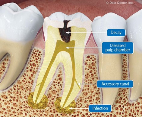 Endodontics https://demo.mcdc.com.kh/wp-content/uploads/2022/05/Endodontics.jpg